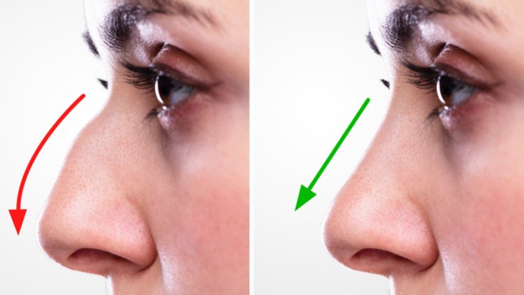 Where to Find the Best Septoplasty Surgeons in Dubai?