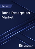 Bone Resorption Market: Mapping the Road to Effective Therapeutic Solutions