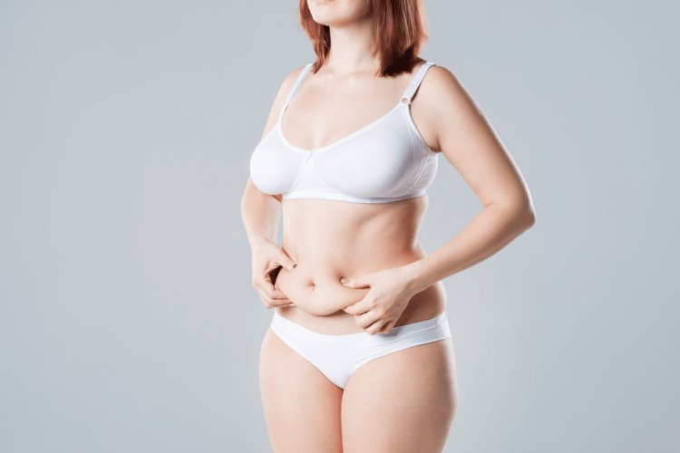 Tummy Tuck Must Requirements: Are You a Good Candidate for Surgery?
