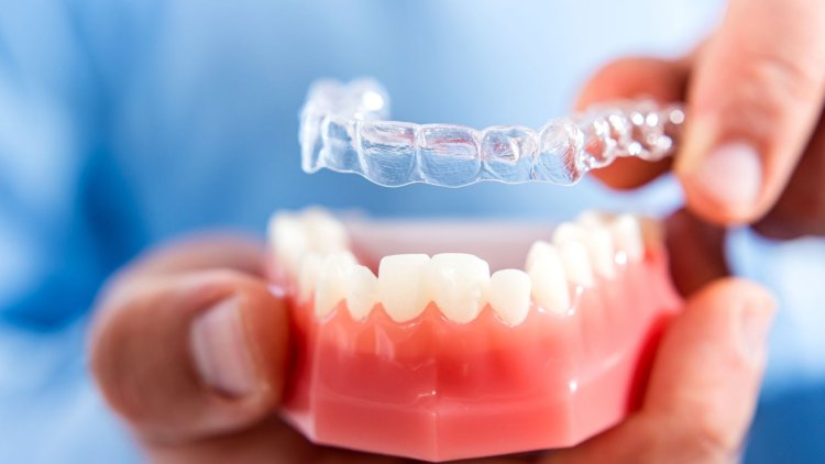 What Are Invisible Aligners?