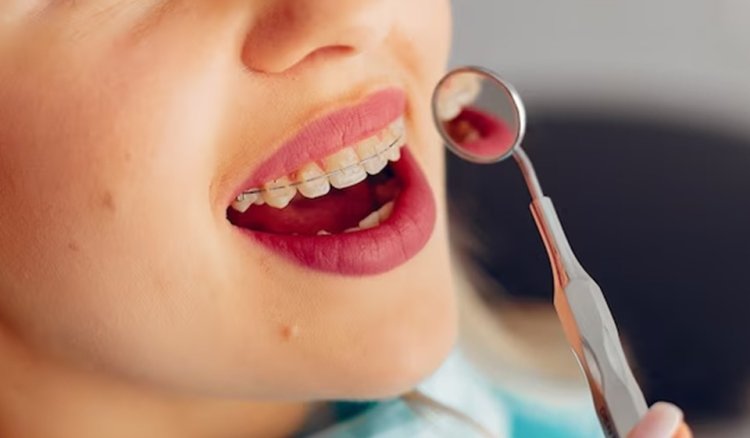 How Orthodontic Treatment Can Improve Your Oral Health