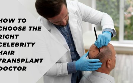 How to Choose the Right Celebrity Hair Transplant Doctor