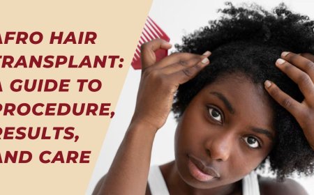 Afro Hair Transplant: A Guide to Procedure, Results, and Care
