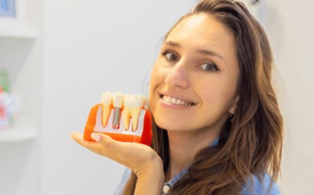 How Dental Implants Improve Your Smile and Bite Function