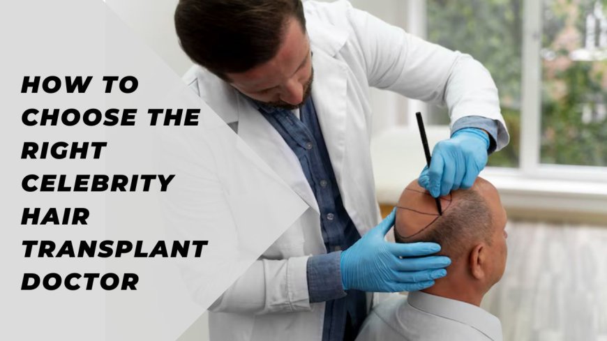 How to Choose the Right Celebrity Hair Transplant Doctor