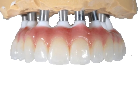 plombe za zube decu: Šta roditelji treba  da znaju