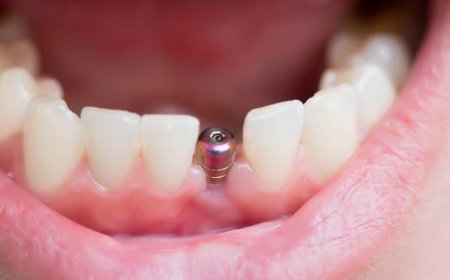 Local Clinics Offering Expert Smile Care in Chichester