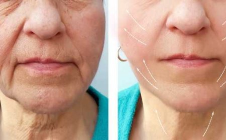 The Botox Journey Brings Noticeable Changes with Patience