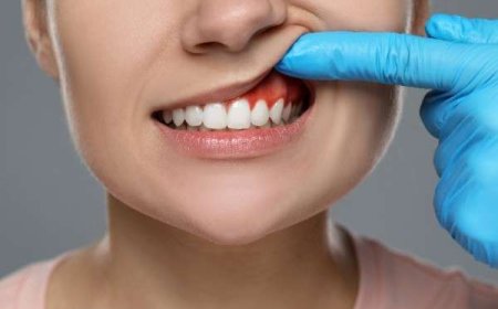 Teeth Whitening Isn’t Universal: Trust Your Dentist’s Expertise