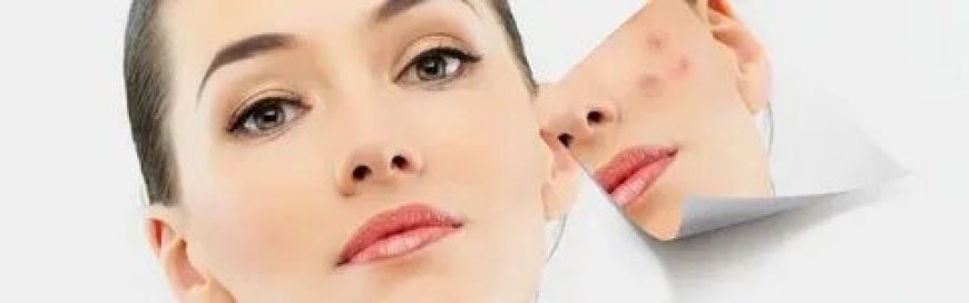 Find an Eczema Doctor Near Me & Botox in Joliet, IL – Top Dermatology Care in Naperville