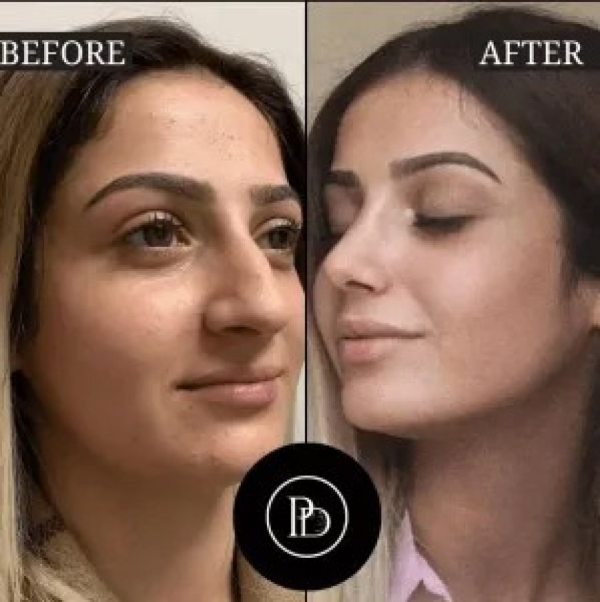 Where to Find the Best Plastic Surgeons in Dubai