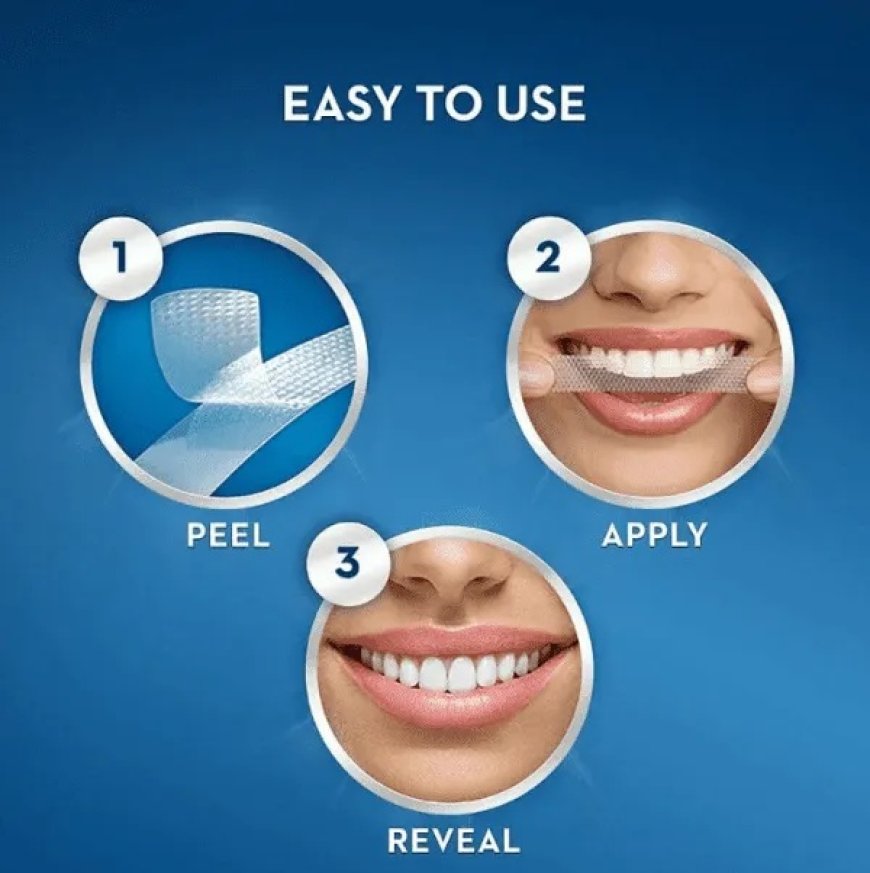 TheWhiteSmiles - Crest Whitestrips for easy whitening