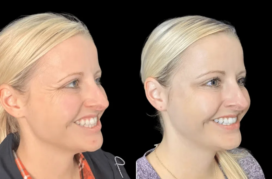The Secret Behind Glowing Skin at the Best Aesthetic Clinic in Dubai