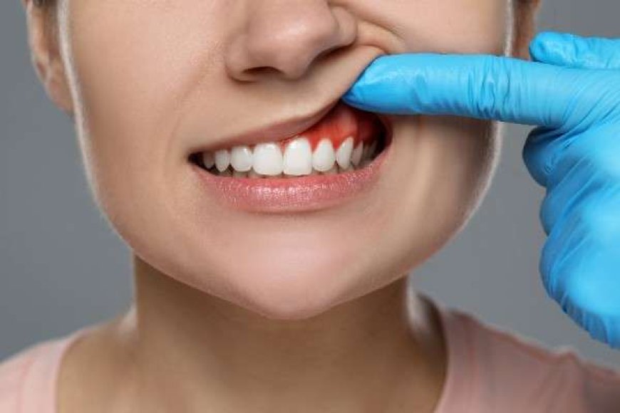 Teeth Whitening Isn’t Universal: Trust Your Dentist’s Expertise