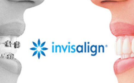 Why Local Reviews Are Your Dental Practice’s Secret Growth Engine