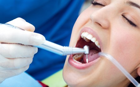 Tooth Cavity Treatment in Oshawa at Groot Dental