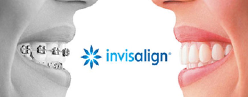 Why Local Reviews Are Your Dental Practice’s Secret Growth Engine