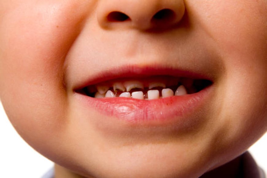 Top Dental Problems in Children and Simple Ways to Prevent Them