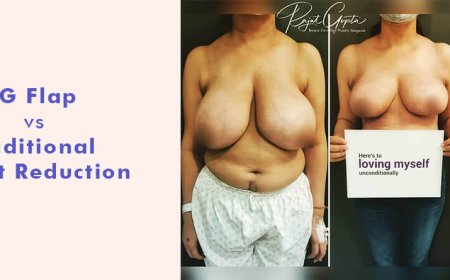Signs You May Need Breast Reduction Surgery