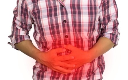 Homeopathy for Ulcerative Colitis – A Natural Path to Long-Term Relief