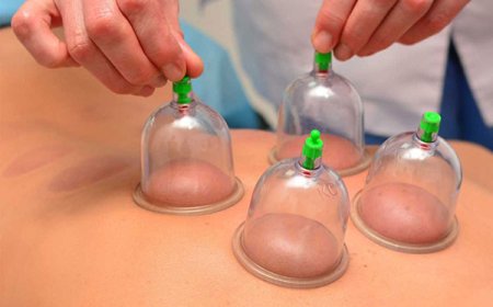 Hijama Therapy in Gurgaon: A Natural Healing Approach for Modern Lifestyles