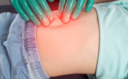 Hernia surgery step by step explained clearly