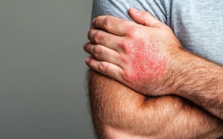 Ciclopirox Nail Lacquer: How Long Does It Take to See Results?