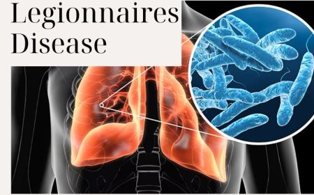 Understanding Legionnaires Disease: Causes, Symptoms, and Prevention