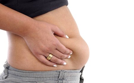 Recover Faster: Tummy Tuck Aftercare Tips That Work