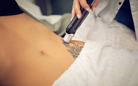 Laser Tattoo Removal: Fade Ink Safely Completely
