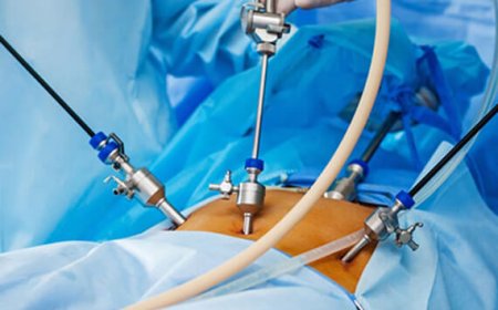 Laparoscopy for Infertility Cost in Delhi - Dr Rhythm Gupta