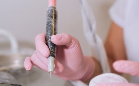 Understanding the True Cost of Electrolysis Hair Removal