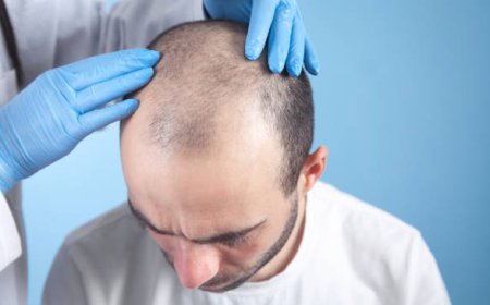 Transform Your Look with Hair Transplant in Riyadh