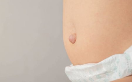 Cost of Hernia Surgery Breakdown: Hidden Fees Explained