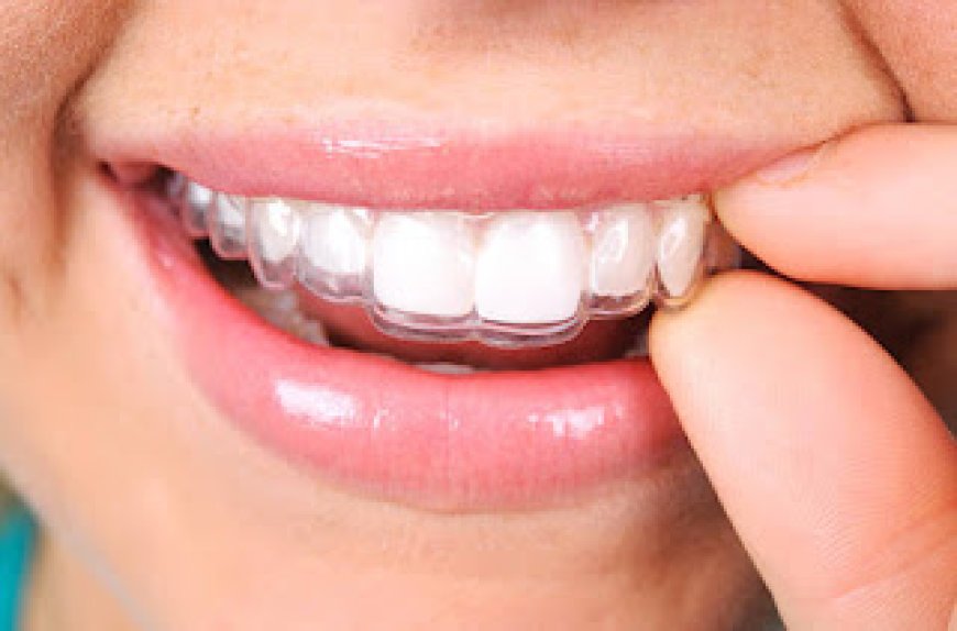 A Confident Smile Starts Here: Transforming Your Teeth With Simpsonville Invisalign