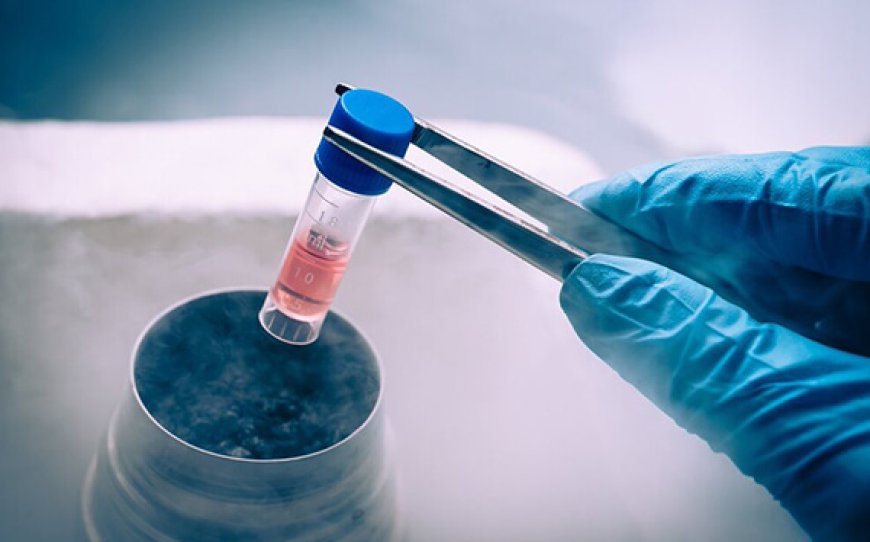 Fertility Preservation in Delhi - Dr Rhythm Gupta