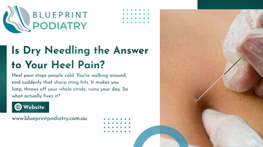 Is Dry Needling the Answer to Your Heel Pain?