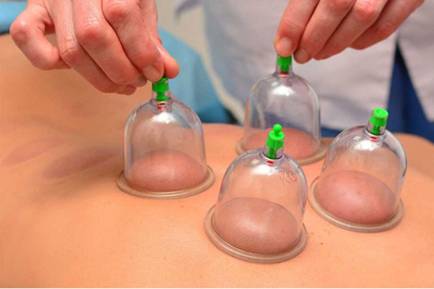 Hijama Therapy in Gurgaon: A Natural Healing Approach for Modern Lifestyles