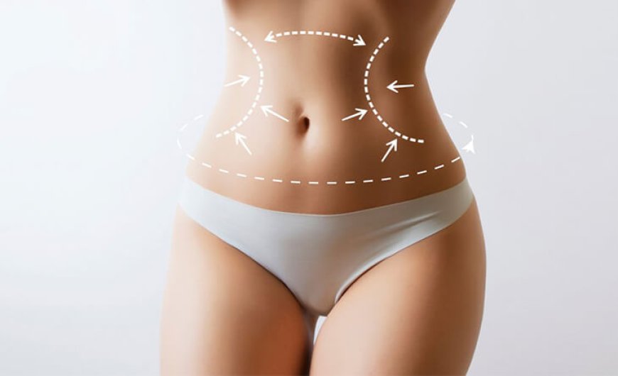 Body Areas Liposuction Treats Best (And Those It Doesn’t)