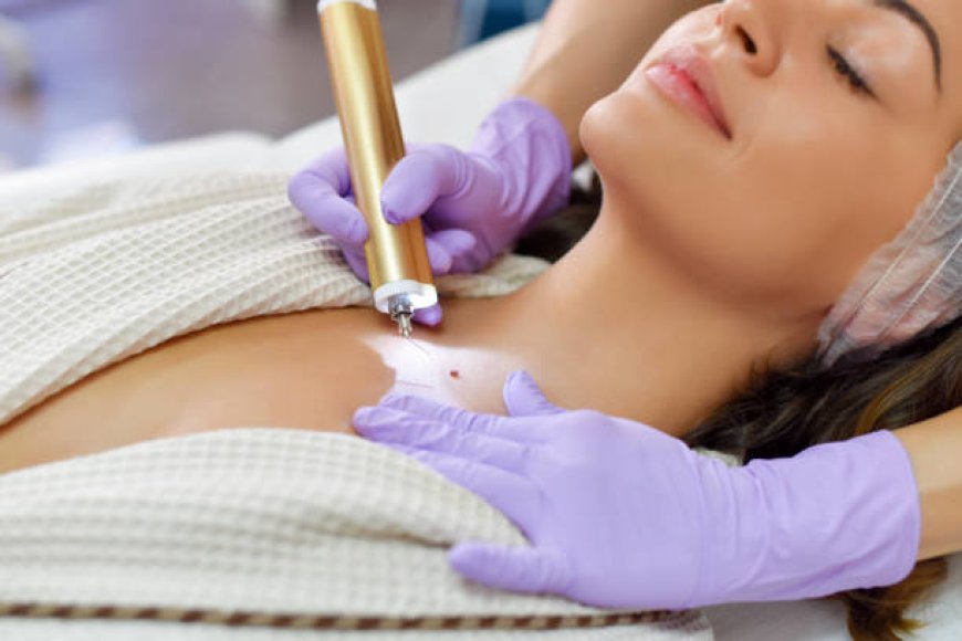 بعد عملية إزالة الشامة: نصائح للعناية بالجلد والشفاء السريع