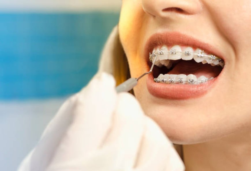 Personalized Orthodontic Care for Healthier Smiles in Center Valley