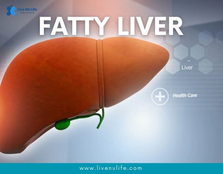 Fatty Liver Disease: Causes, Symptoms, Treatment, Prevention
