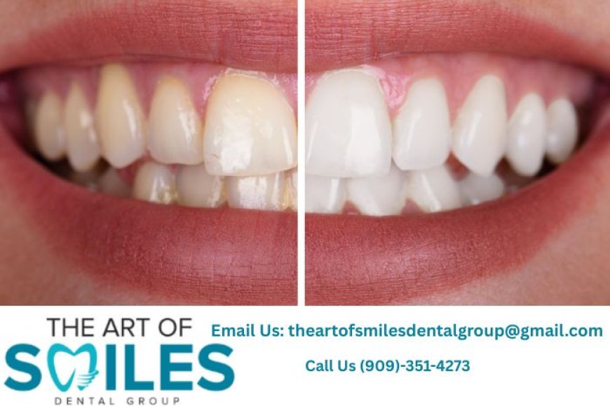 Dentist in Fontana CA | Emergency, Fillings & Wisdom Teeth Care