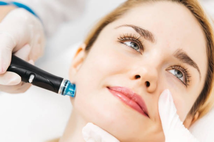 Achieve Flawless Complexion with Hydrafacial