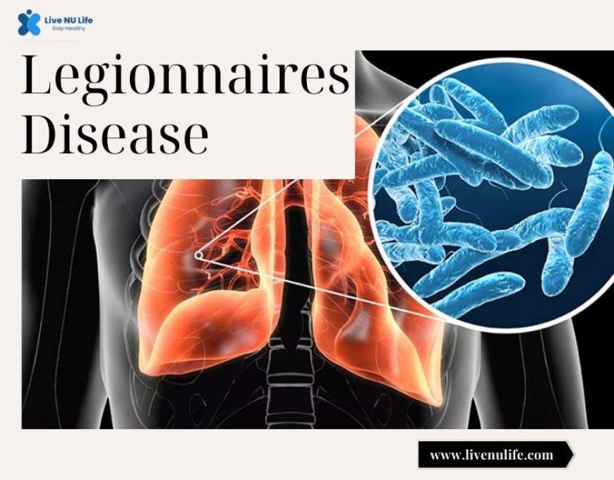 Understanding Legionnaires Disease: Causes, Symptoms, and Prevention