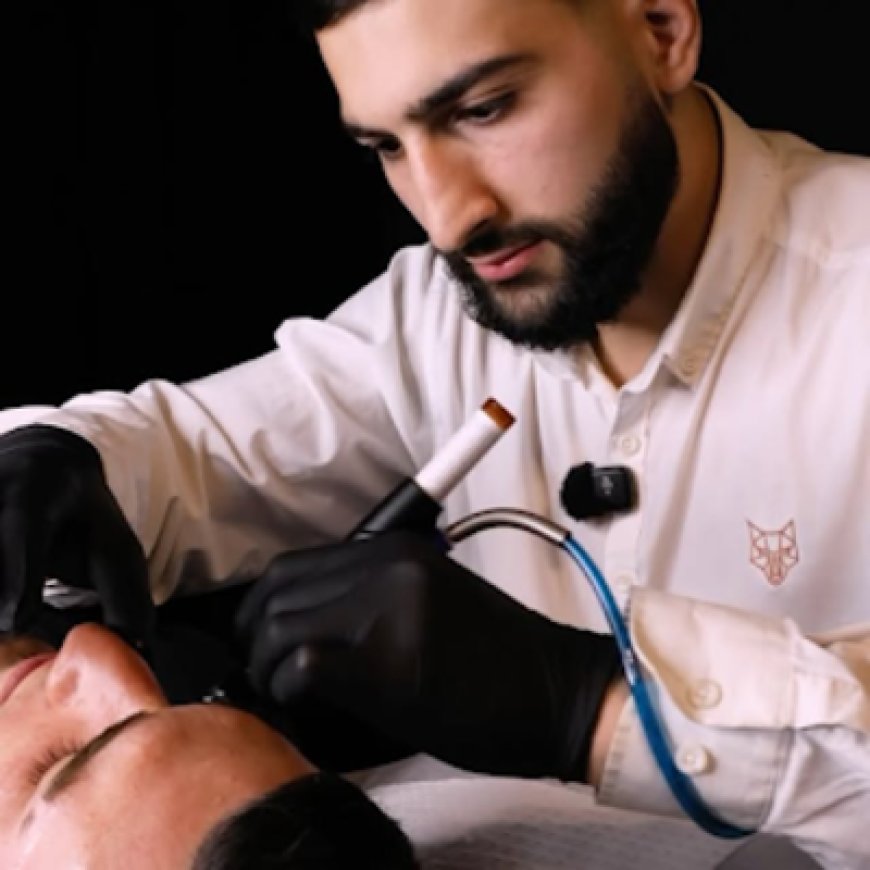 Why Are More Men Choosing Mens Beard Laser in Sydney Today