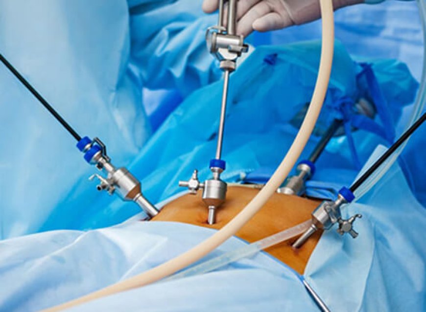 Laparoscopy for Infertility Cost in Delhi - Dr Rhythm Gupta