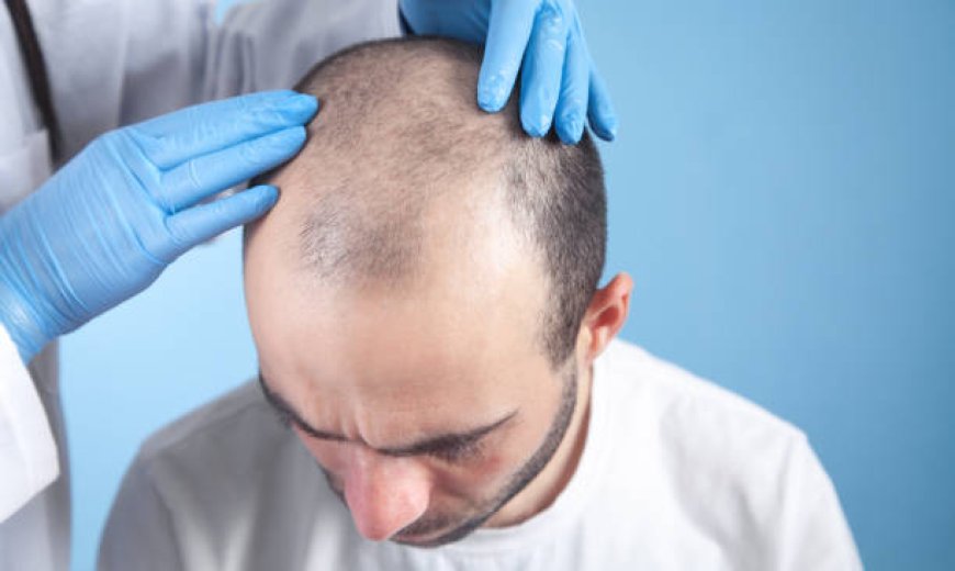 Transform Your Look with Hair Transplant in Riyadh