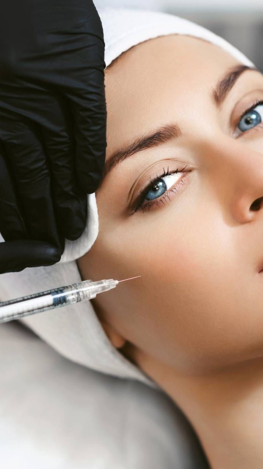 Botox Injections and Facial Balance: More Than Just Smoother Skin