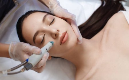 Hydrafacial Procedure Explained: Steps for Deep Cleansing